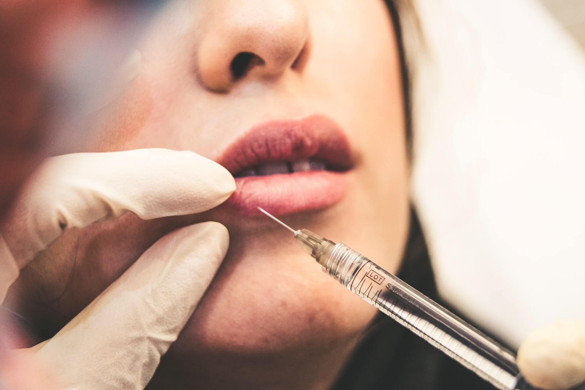 botox lippen