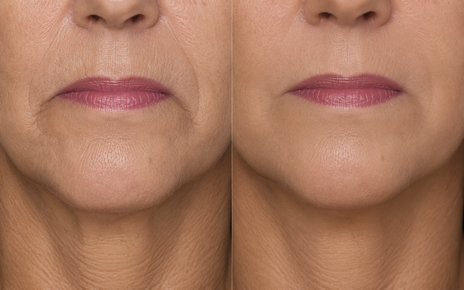 Artistic studio portrait of a woman with brown hair and a neutral expression.