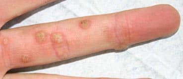 wratten_kliniek_de_medici